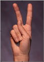 picture-2